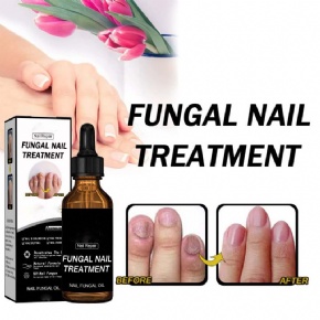 nail Fungus Treatment